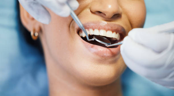 Best Emergency Broken Tooth Repair in Mason Neck, VA